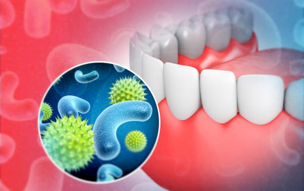 दांत में मिले बैक्टीरिया से बनेगी दवा